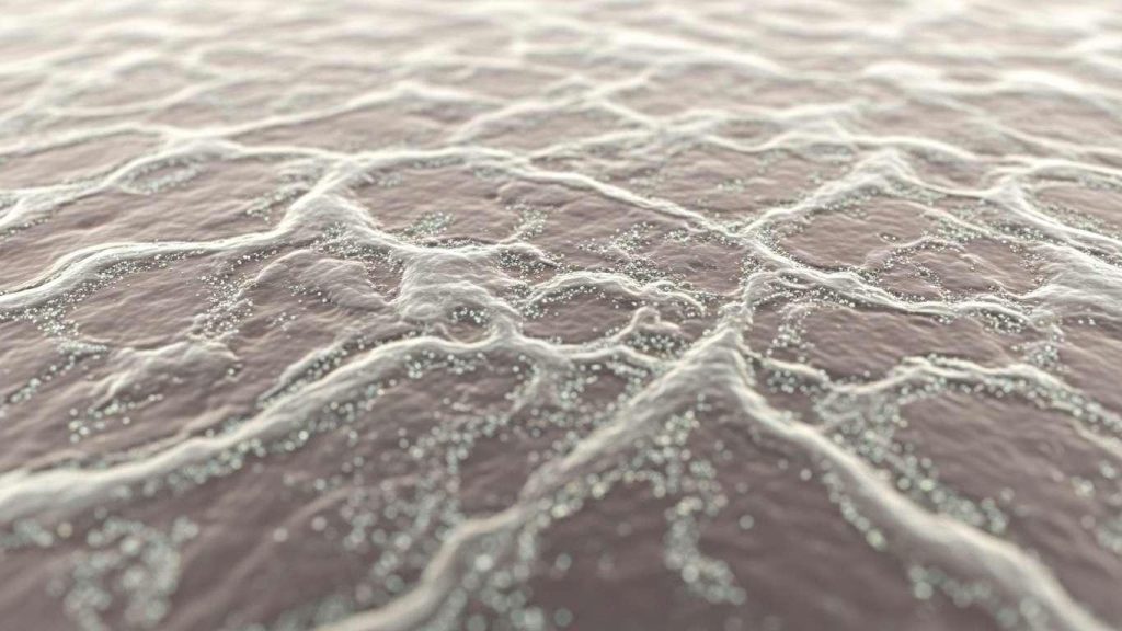 razlichija mezhdu himicheskimi pilingami 2